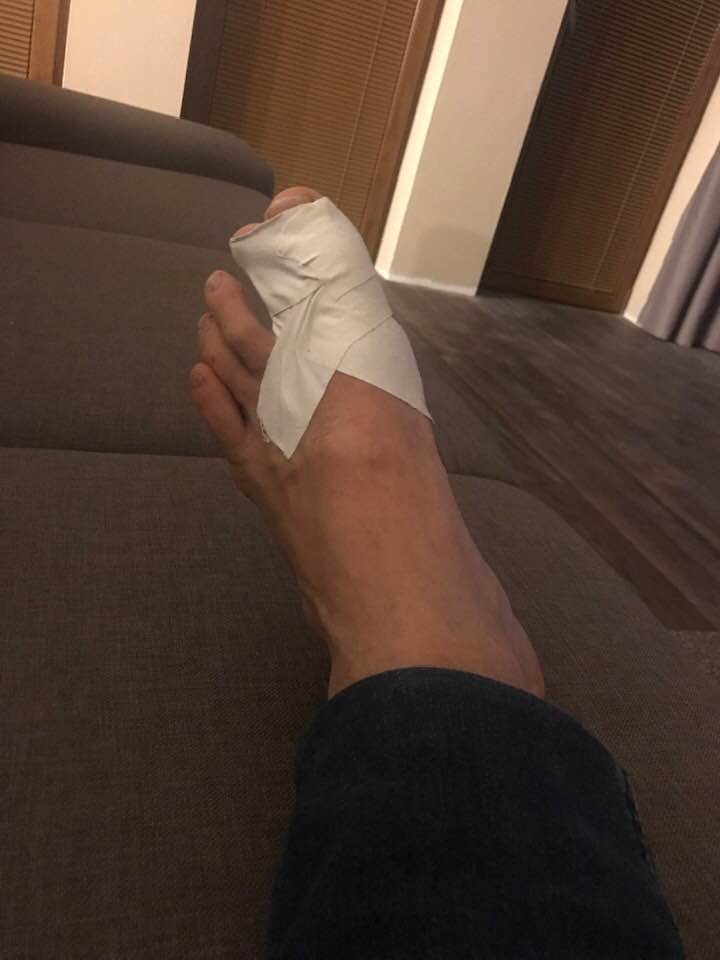 Vlado Voštinár skončil so zlomeným palcom na nohe